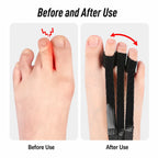 Adjustable Toe Retractor Support