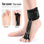 Adjustable Toe Retractor Support