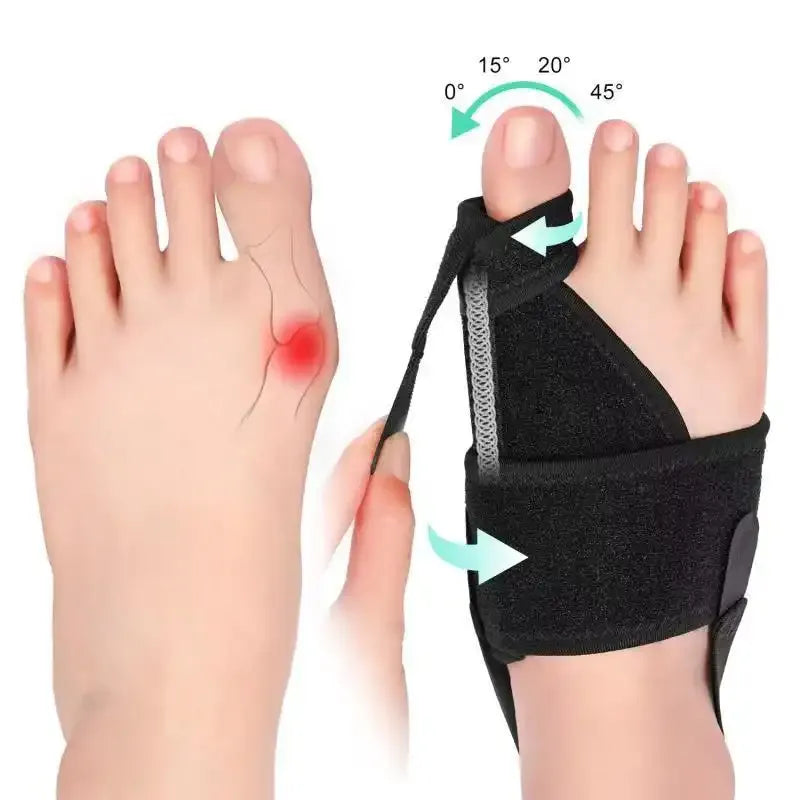 Attelle orthopédique ajustable pour l'hallux valgus, offrant un confort pour le gros orteil